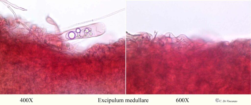 Helvella acetabulum excipulum medullar 400x