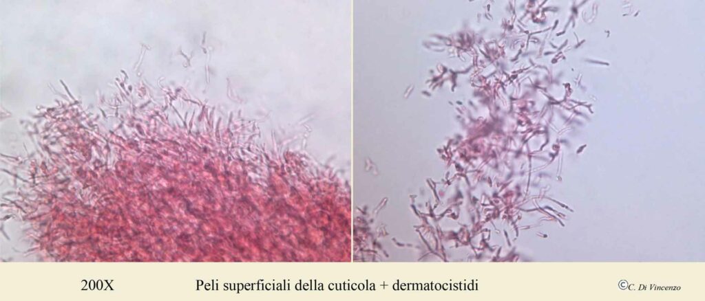 Russula pseudoaeruginea (Romagn.) Kuyper &Vuure 1985 peli superficiali dellacuticola e dermatocisti